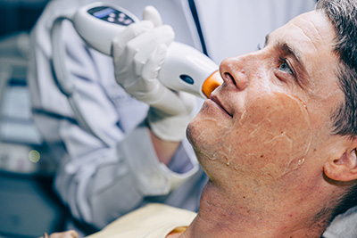 Skin doctor using laser resurfacing facial skincare treatment technology